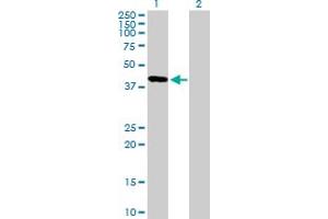 Western Blot analysis of FBXO31 expression in transfected 293T cell line by FBXO31 MaxPab polyclonal antibody. (FBXO31 antibody  (AA 1-367))