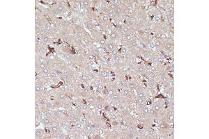 Immunohistochemistry of paraffin-embedded human liver using HLA-DRA antibody (ABIN6131757, ABIN6141827, ABIN6141829 and ABIN6215475) at dilution of 1:100 (40x lens). (HLA-DRA antibody  (AA 26-216))