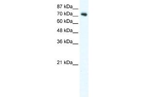WB Suggested Anti-DVL1 Antibody Titration:  2. (DVL1 antibody  (C-Term))