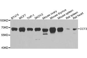 Western blot analysis of extracts of various cell lines, using CCT3 antibody. (CCT3 antibody)