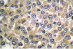 Image no. 1 for anti-Melan A (MLANA) antibody (ABIN265512) (MLANA antibody)