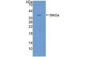 Detection of Recombinant TPP1, Human using Polyclonal Antibody to Tripeptidyl Peptidase I (TPP1) (TPP1 antibody  (AA 1-320))
