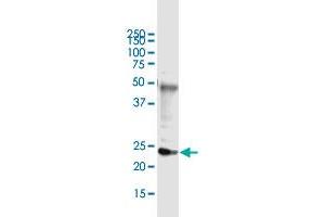 Immunoprecipitation of DDIT4L transfected lysate using anti-DDIT4L monoclonal antibody and Protein A Magnetic Bead , and immunoblotted with DDIT4L MaxPab rabbit polyclonal antibody. (DDIT4L antibody  (AA 94-193))