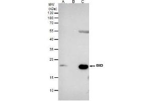 IP Image Bid antibody [N1C3] immunoprecipitates BID protein in IP experiments. (BID antibody)