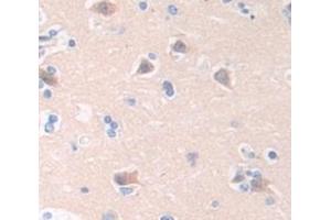 Figure. (RIOK1 antibody  (AA 180-479))