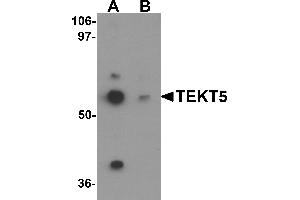 Western blot analysis of TEKT5 in 3T3 cell lysate with TEKT5 antibody at 0. (TEKT5 antibody  (Middle Region))