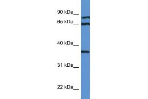 WB Suggested Anti-DHPS AntibodyTitration: 1. (DHPS antibody  (N-Term))