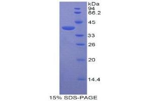 SDS-PAGE (SDS) image for ArfGAP with Dual PH Domains 2 (ADAP2) (AA 49-361) protein (His tag) (ABIN2120787)
