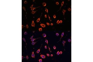 Immunofluorescence analysis of L929 cells using MT- antibody (ABIN7268593) at dilution of 1:100. (MT-ATP6 antibody)