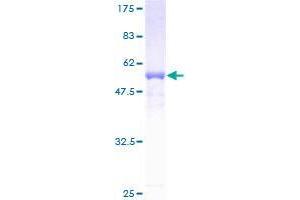SDR16C5 Protein (AA 26-309) (GST tag)