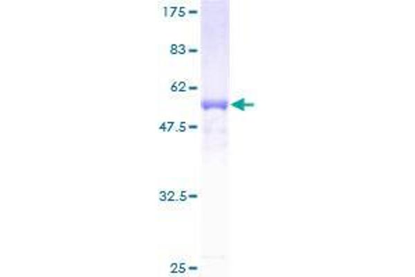 SDR16C5 Protein (AA 26-309) (GST tag)