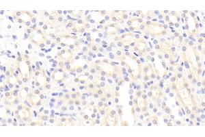 Detection of IBA1 in Mouse Kidney Tissue using Polyclonal Antibody to Ionized Calcium-binding Adapter Molecule 1 (IBA1) (Iba1 antibody  (AA 35-102))