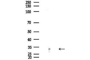 anti-E3 Ubiquitin-Protein Ligase SIAH1 (SIAH1) (N-Term) antibody