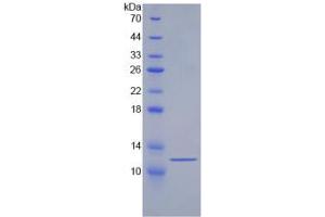SDS-PAGE analysis of Human HSPA8 Protein.