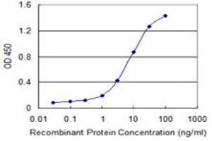 Detection limit for recombinant GST tagged CDC42BPG is 0. (MRCKG antibody  (AA 1423-1528))