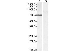 ABIN184571 (0. (GADD34 antibody  (C-Term))