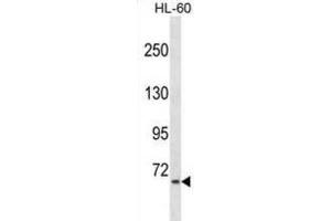 Western Blotting (WB) image for anti-A Kinase (PRKA) Anchor Protein 8-Like (AKAP8L) antibody (ABIN2999440) (AKAP8L antibody)