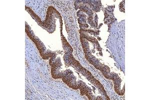 IHC analysis of TRMT61A using anti-TRMT61A antibody (ABIN7599220). (TRMT61A antibody  (AA 1-289))