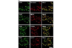 Vesicular nucleotide transporter (VNUT) was present in the dense granules of human platelets. (LAMP1 antibody)