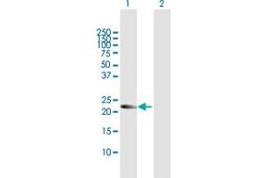 Western Blot analysis of AMN1 expression in transfected 293T cell line by AMN1 MaxPab polyclonal antibody. (AMN1 antibody  (AA 1-213))