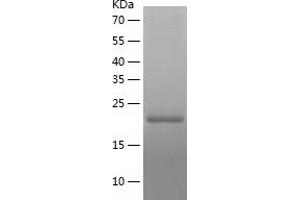 Western Blotting (WB) image for Potassium Channel Tetramerisation Domain Containing 17 (KCTD17) (AA 67-230) protein (His tag) (ABIN7287930) (KCTD17 Protein (AA 67-230) (His tag))