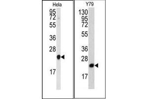 Image no. 1 for anti-Phosphatidylethanolamine Binding Protein 1 (PEBP1) (N-Term) antibody (ABIN360563) (PEBP1 antibody  (N-Term))