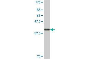 Western Blot detection against Immunogen (35. (ENC1 antibody  (AA 17-98))