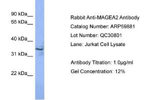 WB Suggested Anti-MAGEA2  Antibody Titration: 0. (MAGEA2 antibody  (N-Term))