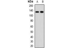 Western blot analysis of PDGFR beta expression in HepG2 (A), NIH3T3 (B) whole cell lysates. (PDGFRB antibody)