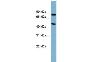 WB Suggested Anti-PANK4 Antibody Titration: 0. (PANK4 antibody  (N-Term))