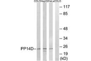 Western blot analysis of extracts from HeLa/HepG2/COLO cells, using PPP1R14D Antibody. (PPP1R14D antibody  (AA 66-115))