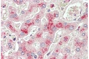 ABIN5539740 (5 μg/mL) staining of paraffin embedded Human Liver. (LCAT antibody  (AA 366-378))