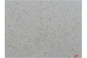 CACNA1I antibody