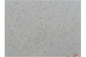 Immunohistochemistry (IHC) analysis of paraffin-embedded Mouse Brain Tissue using Cav3. (CACNA1I antibody)