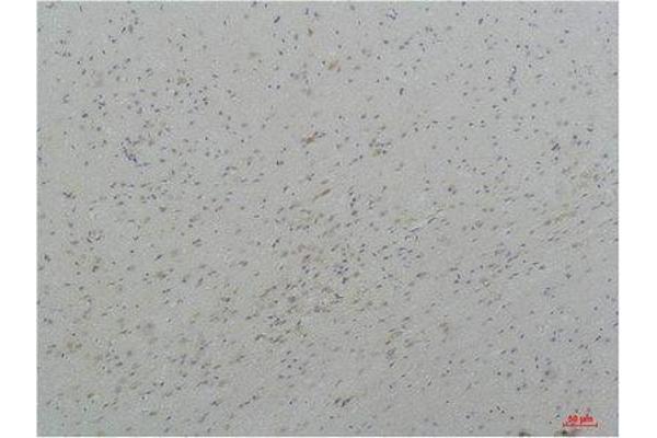 CACNA1I antibody