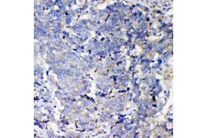 IHC analysis of IQGAP2 using antiIQGAP2 antibody (ABIN5692877). (IQGAP2 antibody  (AA 1329-1544))
