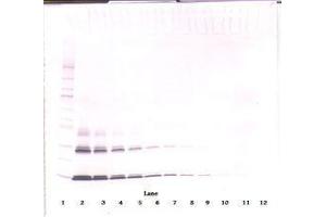 Image no. 2 for anti-Interleukin 3 (IL-3) antibody (ABIN465873) (IL-3 antibody)