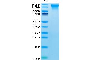 Mouse TEM1 on Tris-Bis PAGE under reduced condition. (CD248 Protein (AA 18-695) (His tag))