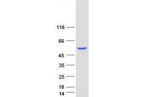 Validation with Western Blot (ABAT Protein (Transcript Variant 1) (Myc-DYKDDDDK Tag))