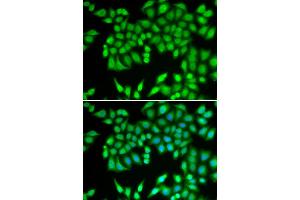 Immunofluorescence analysis of U2OS cell using MCM3 antibody.