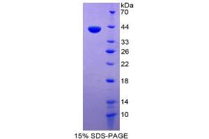 SDS-PAGE (SDS) image for Chemokine (C-C Motif) Ligand 1 (CCL1) (AA 24-96) protein (His tag,GST tag) (ABIN2122603)