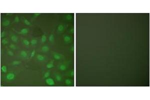 Immunofluorescence analysis of HepG2 cells, using C/EBP-beta (Phospho-Thr235/188) Antibody. (CEBPB antibody  (pThr235))