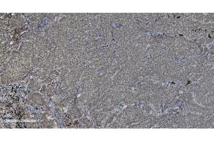 IHC analysis of PARP using anti-PARP antibody (ABIN7602277).