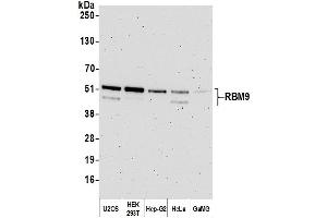 Western Blotting (WB) image for anti-RNA Binding Motif Protein 9 (RBM9) (AA 1-50) antibody (ABIN7454680) (RBM9 antibody  (AA 1-50))