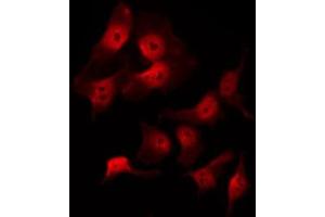 ABIN6269097 staining 293 by IF/ICC. (KRT8 antibody  (C-Term))