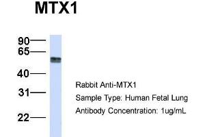 Host:  Rabbit  Target Name:  MTX1  Sample Type:  Human Fetal Lung  Antibody Dilution:  1. (Metaxin 1 antibody  (C-Term))