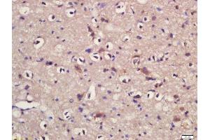 Formalin-fixed and paraffin embedded rat brain labeled with Rabbit Anti-KLC1/KNS2 Polyclonal Antibody, Unconjugated (ABIN1385823) at 1:200 followed by conjugation to the secondary antibody and DAB staining