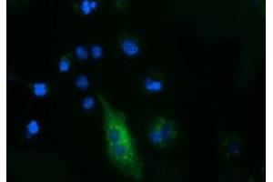 Anti-FSHB mouse monoclonal antibody (ABIN2453055) immunofluorescent staining of COS7 cells transiently transfected by pCMV6-ENTRY FSHB (RC214616). (FSHB antibody)