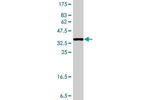 Western Blot detection against Immunogen (36. (EXOSC2 antibody  (AA 71-160))