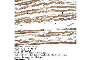 Human Muscle (NFATC4 antibody  (Middle Region))